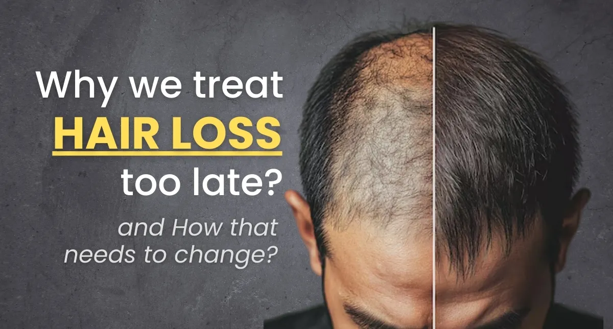 Why We Treat Hair Loss Too Late — Best Hair Loss Treatment Options